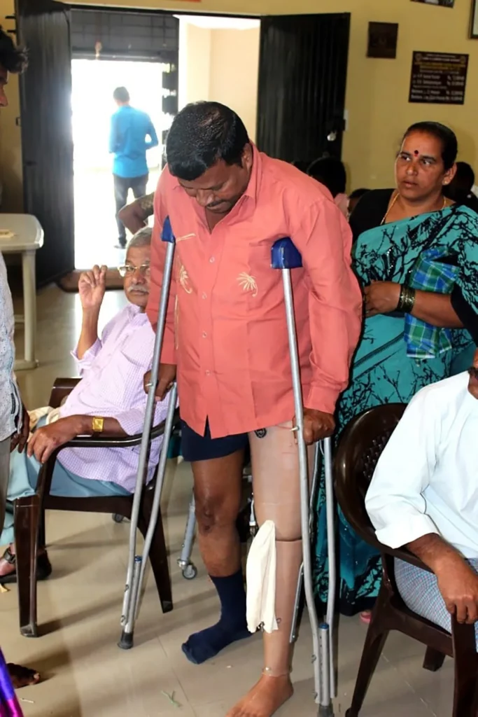 Handicapped man with prosthetics by QNET India and Lions Club