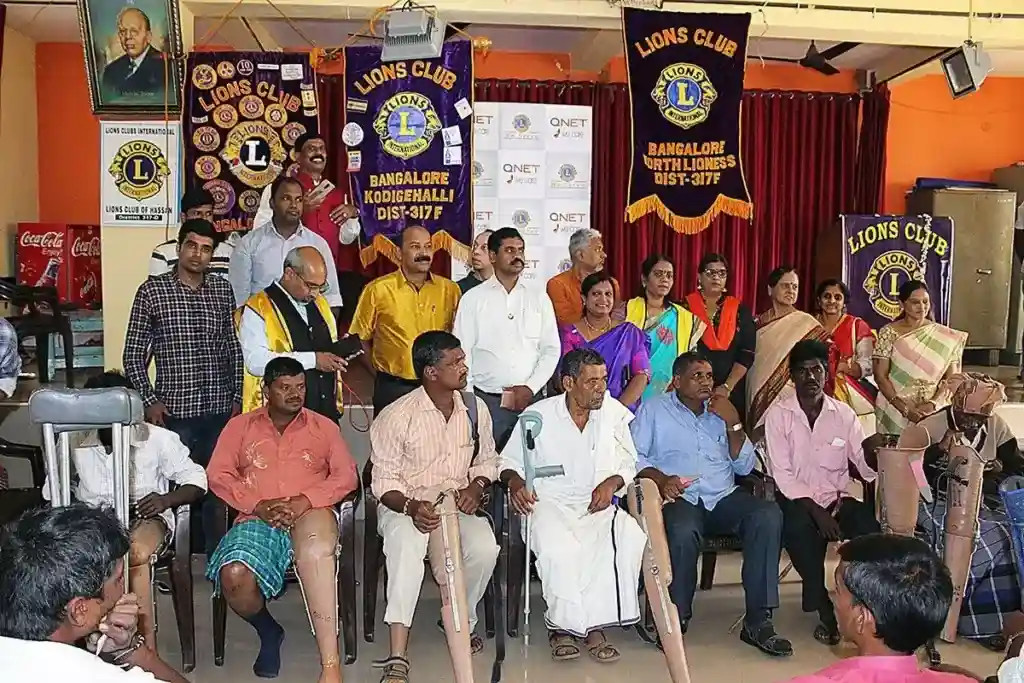 QNET India with Lions Club provide prosthetic limbs in Hassan, Karnataka